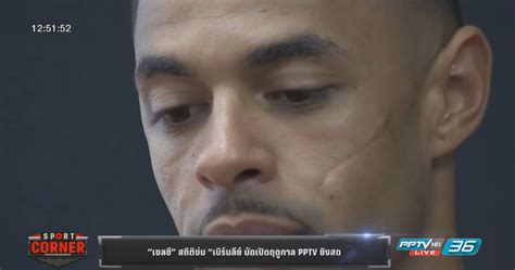 Sbobet8up ดูบอลสด ดูบอลสด พรีเมียร์ลีกอังกฤษ คู่ระหว่าง เบิร์นลีย์ vs ลีดส์ยูไนเต็ด แข่งขันวันที่ 1 ม.ค. "เชลซี" สถิติข่ม "เบิร์นลีย์" นัดเปิดฤดูกาล PPTV ยิงสด ...