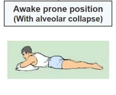 The Use Of Prone Positioning In Covid