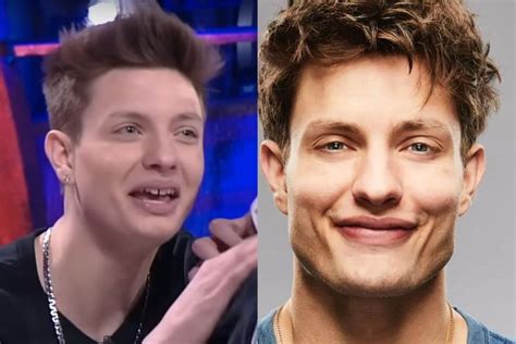 Matt Rife Before And After In 2024 Rhinoplasty Plastic Surgery