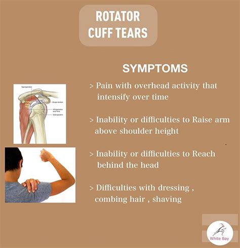 Rotator Cuff Tears You Can Get Back To Normal Even With A Full Rotator