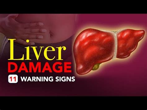 Signs Of Liver Damage