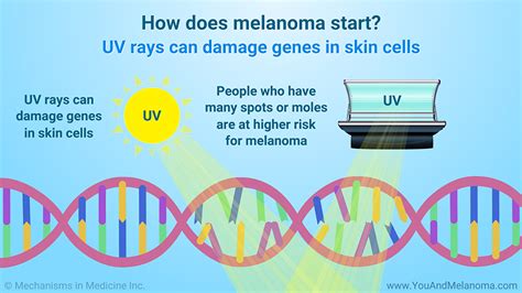 Slide Show Genetic Mutations And Melanoma