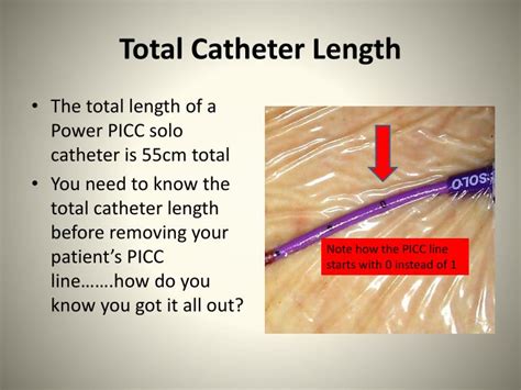 How To Measure Picc Line External Length
