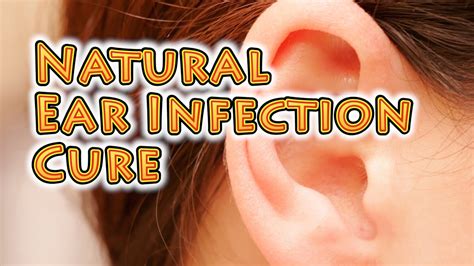 Natural Ear Infection Cure Youtube