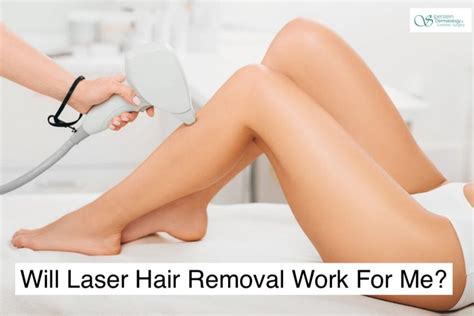 Does Laser Hair Removal Really Work Siperstein Dermatology Group