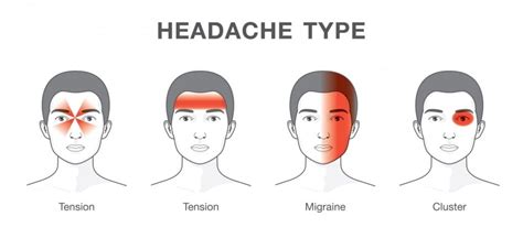 Headache Or Migraine Be Vet Strong