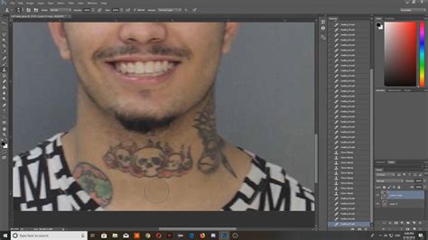 Removing Lil Pumps Face And Neck Tattoos Youtube