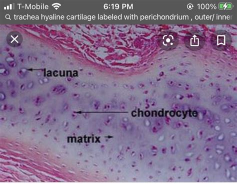Pin By Rachel Thornton On Anatomy Section 2 In 2021 Hyaline Cartilage