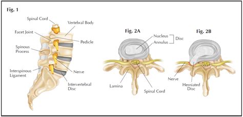 Anatomical terms are used to describe specific areas and movements of the body as well as the relation of body parts to each other. 'Slipped Disc' FAQs - Spine Surgery - Health Information - Hong Kong Spine and Pain Centre