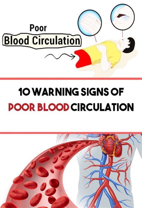 10 Warning Signs Of Poor Blood Circulation