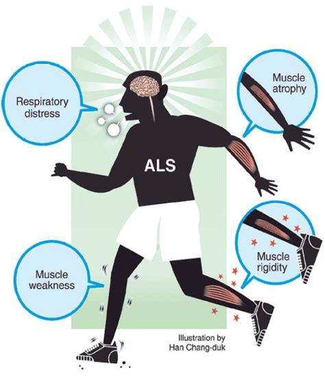 Amyotrophic Lateral Sclerosis