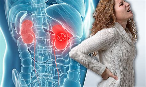 Kidney cancer becomes more likely as you age. Kidney cancer symptoms: See a doctor if you have a pain in ...