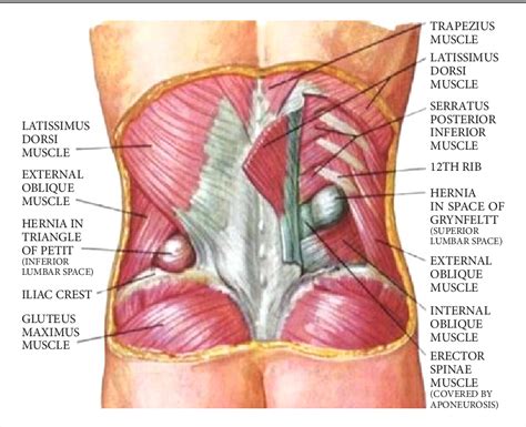 Laparoscopic Repair Of Lumbar Hernia A Case Report And Mini Review