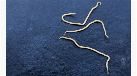 How To Detect Worms In Children Forcesurgery24