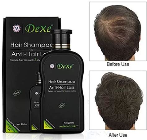 200ml Dexe Anti Hair Loss Shampoo Lazada