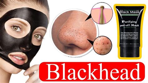How To Remove Blackheads Naturally Easy Diy Blackhead Remover Peel