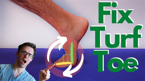 Turf Toe Injury Best Treatment Causes Symptoms And 3 Grades Youtube