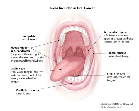 Diagram Of An Open Mouth Showing The Different Areas Included In Oral Cancer