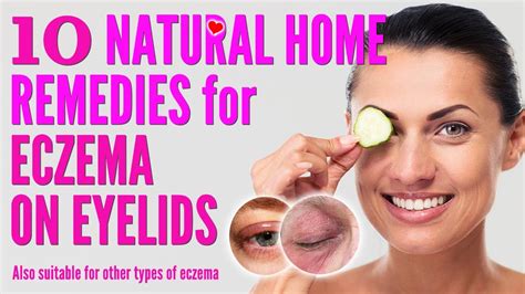 10 Best Natural Home Remedies For Eczema On Eyelids How To Treat