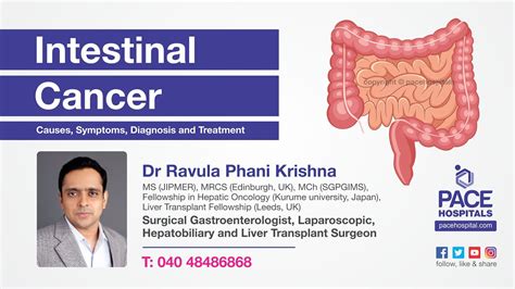 Intestinal Cancer Symptoms Diagnosis Screening Treatment And
