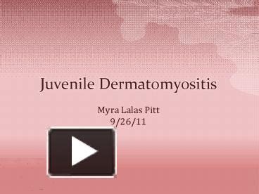 Ppt Juvenile Dermatomyositis Powerpoint Presentation Free To