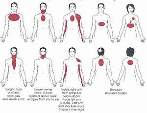 3 Visceral Referral Patterns Flashcards Quizlet