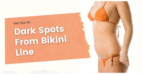 Dark Spots On Bikini Line Ibikini Cyou My XXX Hot Girl