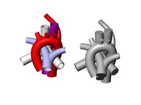 Aberrant Right Subclavian Artery Anomaly 3D Print Model Heart