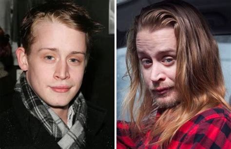 Horrible 18 Shocking Photos Of Famous Celebrities Before