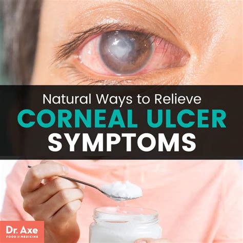 Corneal Ulcer Symptoms Relieve Symptoms Natural Ways Dr Axe