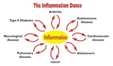The Top 9 Natural Remedies For Inflammation Mom Blog Now