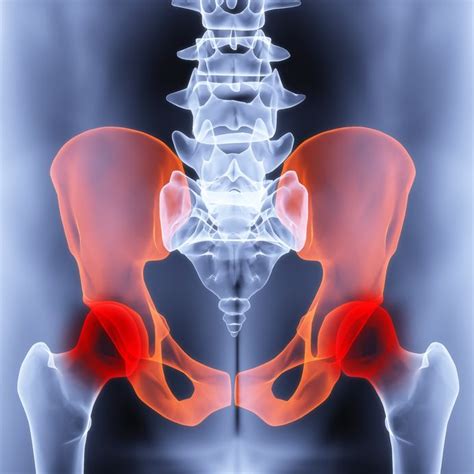 Groin Injuries Groin Injury Symptoms And Treatment