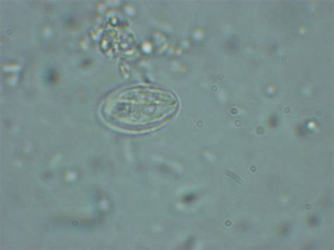 Parasite Called Giardia