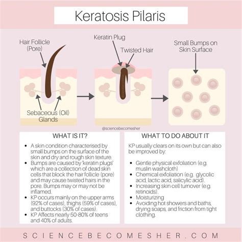 Science Becomes Her Keratosis Pilaris Skin Care Skin Script