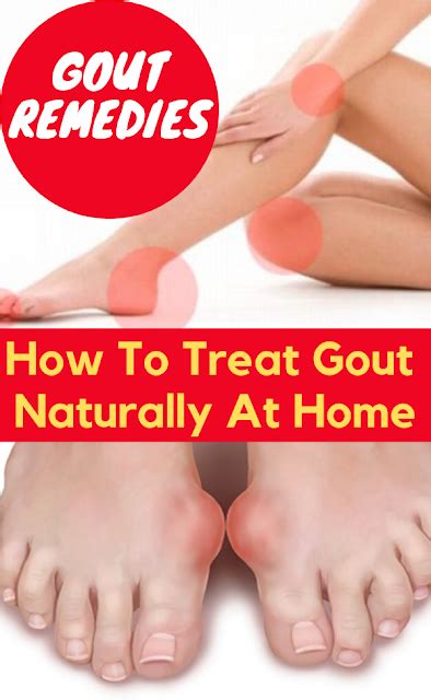 Gout Remedies How To Treat It Naturally At Home Gout Remedies How
