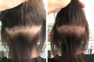 In addition, a hair weave should be placed where the. Can-Hair-Extensions-Damage-Hair-2 - NuTress