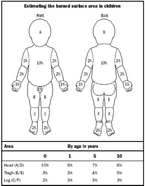 Burns In Children Public Health Notes