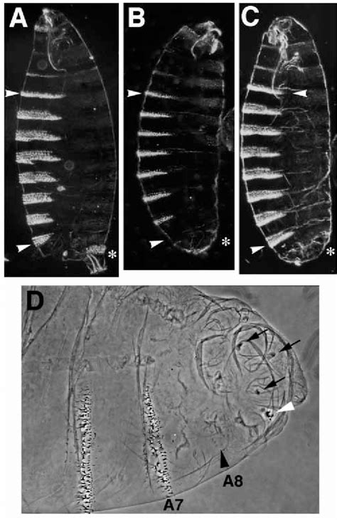 The Cuticular Defects Of Lin Mutant Embryos Partially Resemble Those Of Download Scientific