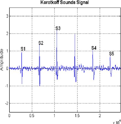 Figure 3 From The Characteristics Of Korotkoff Sounds Using The