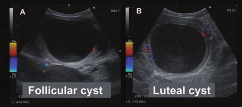 Color Doppler Images Of A Follicular Cyst A And A Luteal Cyst Download Scientific Diagram