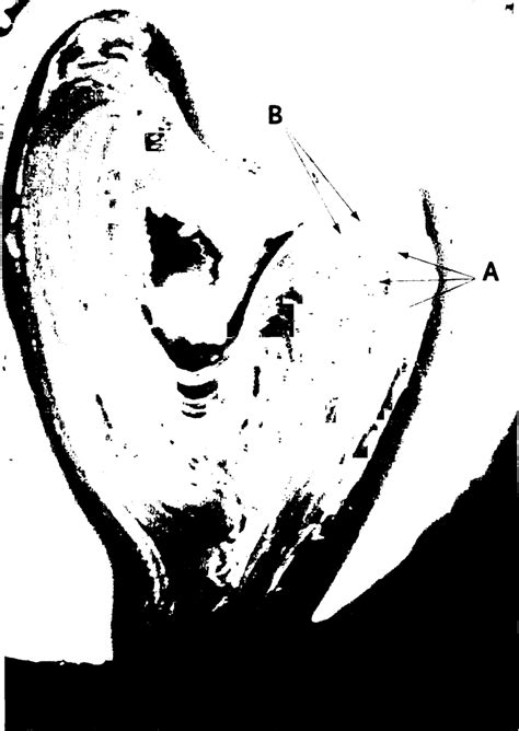 This is a cross section through decalcified bone. Dentary bone cross section from a paddlef ish , age-class ...