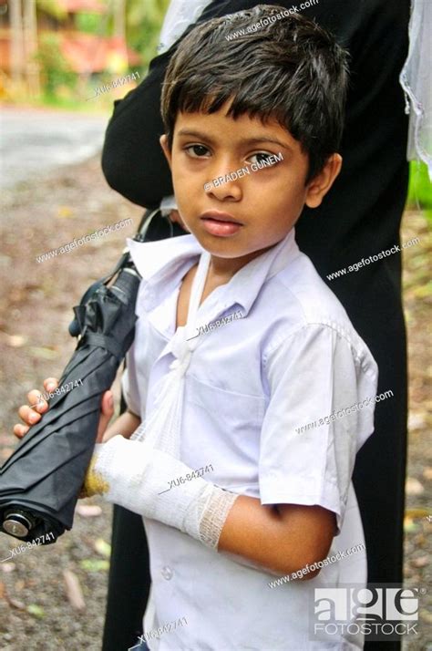 A Young Boy With A Hut Arm Kerala India Stock Photo Picture And