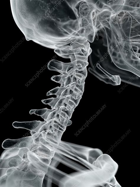 Human Cervical Spine Artwork Stock Image F0094209 Science Photo