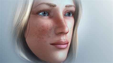 Freckles Types Causes And Treatment Scientific Animations