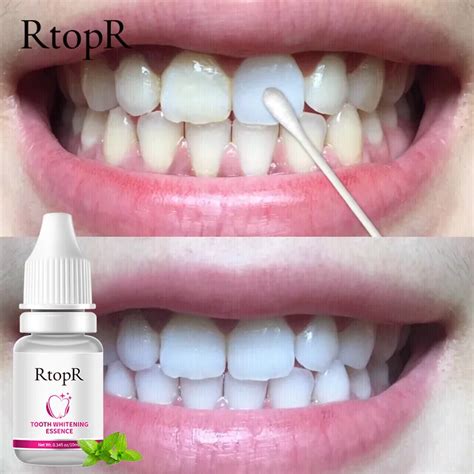 Rtopr Teeth Whitening Essence Oral Hygiene For Remove Stains Plaque
