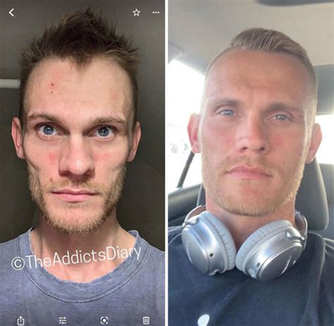 How Drug Addiction Looks Before And After 40 Pics