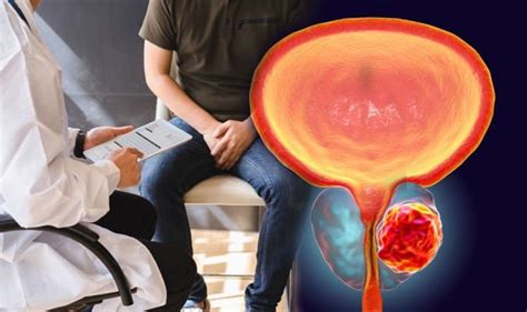 prostate cancer if a man experiences this sexual symptom it could mean they are at risk