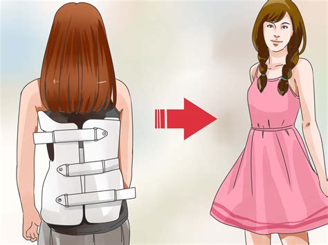3 Ways To Cover Up A Boston Brace For Girls Wikihow
