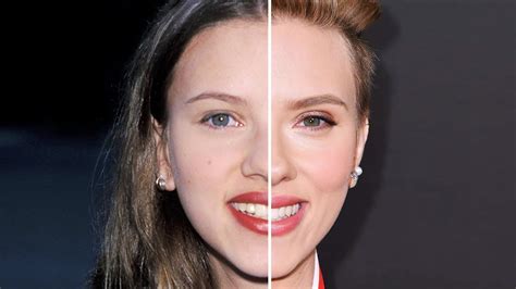 Scarlett Johansson Before And After Plastic Surgery Youtube