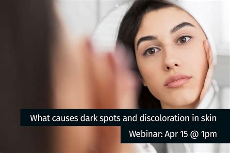 What Causes Dark Spots And Discoloration In Skin Reviva Labs